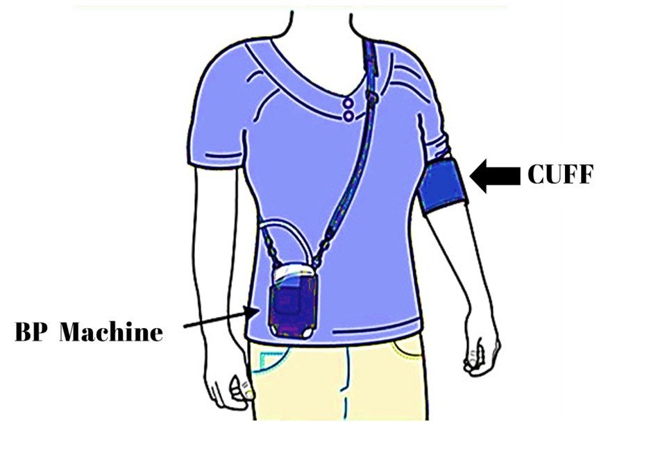"Ambulatory Blood Pressure Monitoring Device for 24-Hour BP Tracking"
