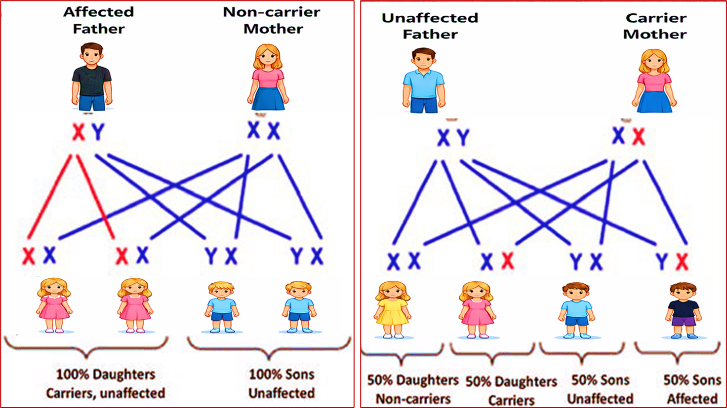 Hemophilia Inheritance