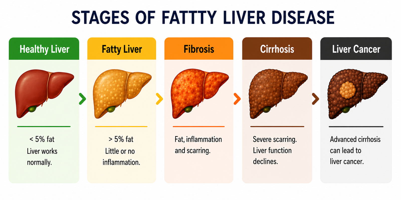 Stages of Fatty Liver Disease