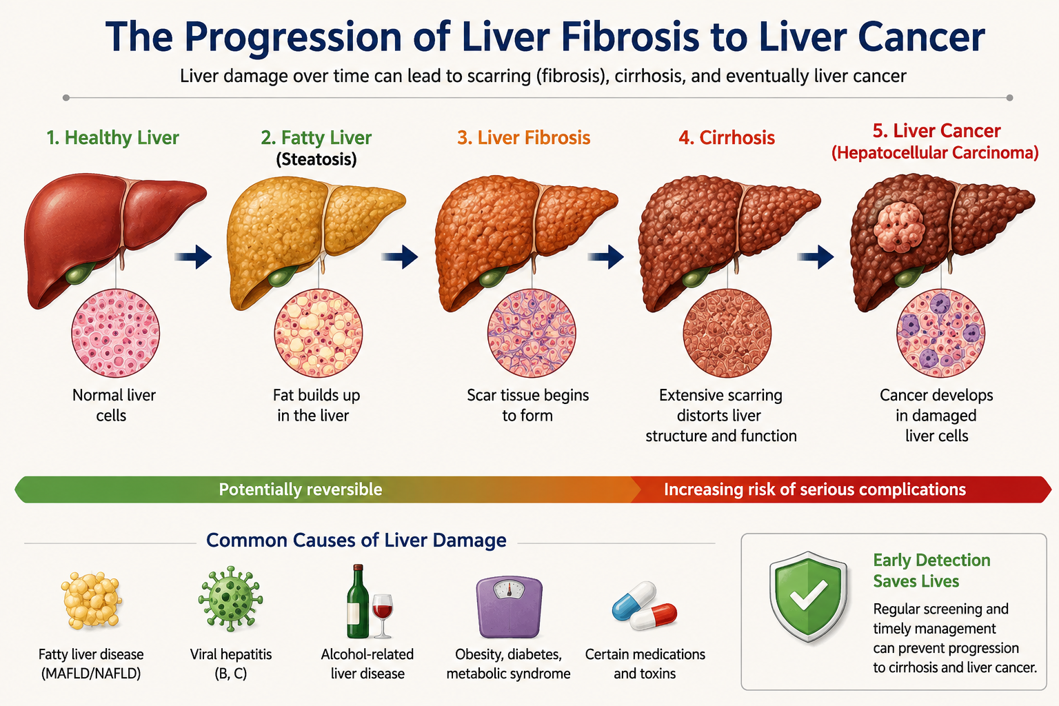 Liver Fibrosis Progression
